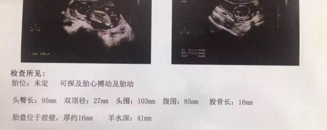 实时发布湖北省私立供卵助孕机构前十,附2023供卵助孕机构选择指南大全