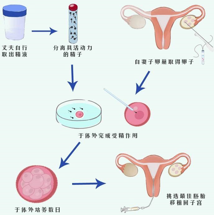 什么时候做试管能纳入医保