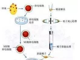 育儿广西哪个医院做试管