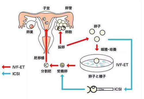 供卵试管代怀电话特别聪明南宁借卵代生子为什么比国内好（五个方面体现）