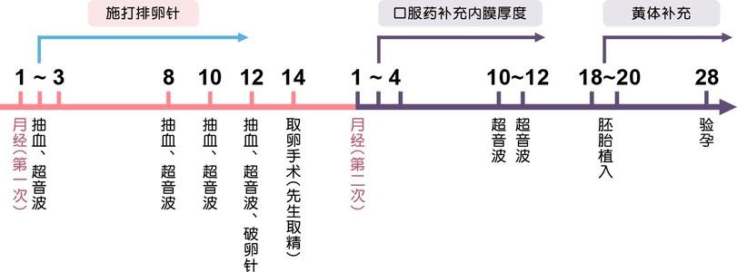 盆腔积液影响试管移植吗+盆腔积液到底会影响试管移植吗