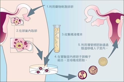 试管代怀包生仔过程-国内供卵代生机构疗程中,第3天胚胎、囊胚移植哪一种胚胎更好呢